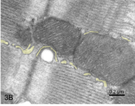 elektrónový mikrosnímok z pozdĺžnej oblasti srdcovej svalovej bunky